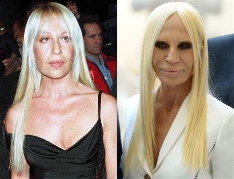 donatella versace before surgey|donatella versace plastic surgery 2022.